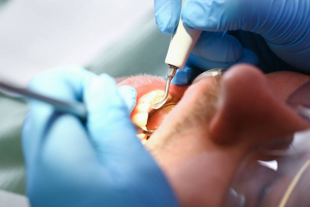 Best Dentist for Tooth Abscess  in Baraga, MI